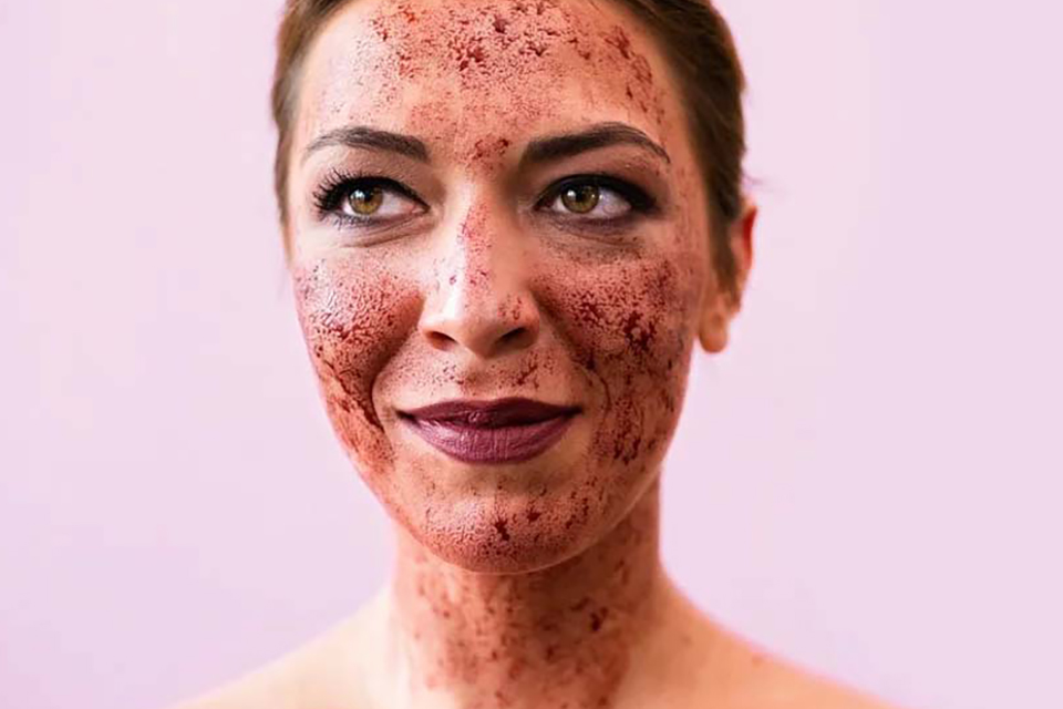 Waspada Bahaya Vampire Facial, Ini Cara Pilih Klinik Tepercaya